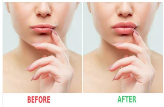 Rose Lip Plumper - MOQ 12pcs