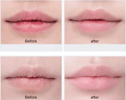 Lip Stories Nourishing Repair Balm – Deep Moisture & Care | MOQ 25 pcs