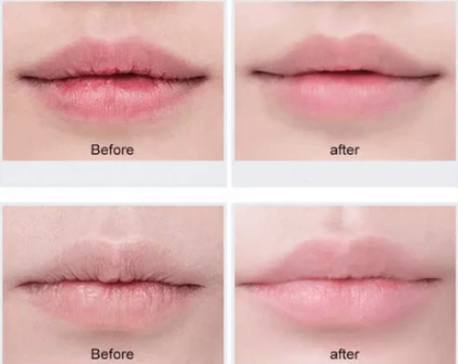Lip Stories Nourishing Repair Balm – Deep Moisture & Care | MOQ 25 pcs